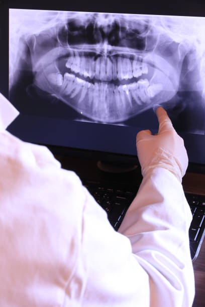 Best Knocked-Out Tooth (Avulsed Tooth) Treatment in Desert Edge, CA